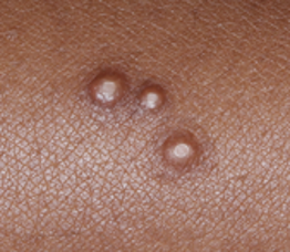 Allow YCANTH Solution to completely dry